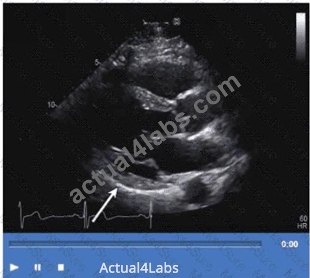 [Q78-Q102] AE Adult Echocardiography Examination Practice Tests 2025 ...